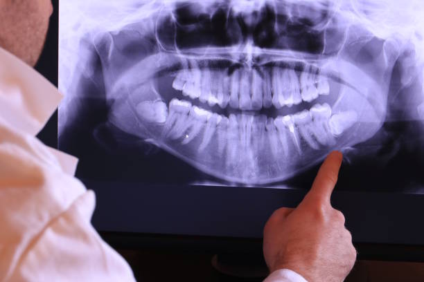 Best 24-Hour Emergency Dentist in Clinton, IA