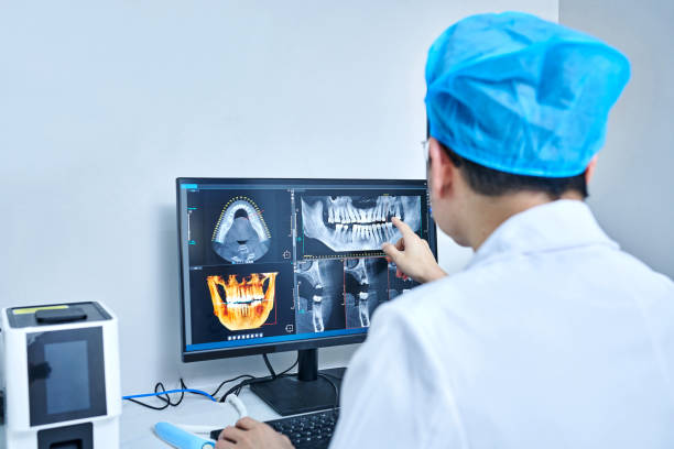 Best Emergency Tooth Extraction in Clinton, IA