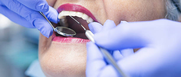 Best Emergency Tooth Extraction in Clinton, IA