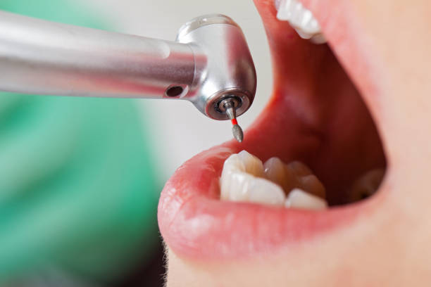 Best Weekend Emergency Dentist in Clinton, IA